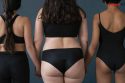 Lipedema Awareness